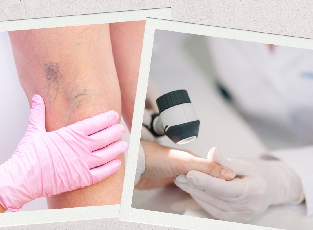 HCSPL | Dermatologia e Cirurgia Vascular 